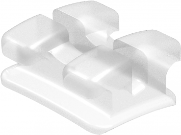 smartbrace Luminar White, MBT 22, für Zahn Nr. 21